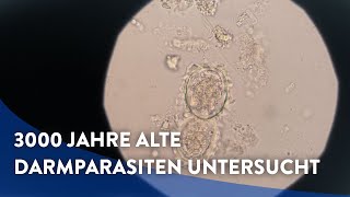 Hallstatt 3000 Jahre alte Darmparasiten untersucht [upl. by Nylad]