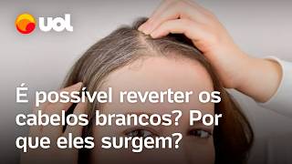 Cabelo branco é possível reverter Estresse sono irregular e má alimentação influenciam confira [upl. by Donica]