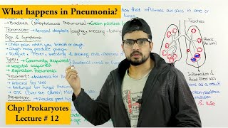 Pneumonia disease  Causes Symptoms Transmission prevention and treatment [upl. by Phyl]