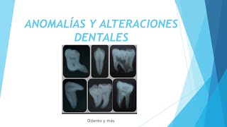 Anomalías y alteraciones dentales [upl. by Eehtomit]