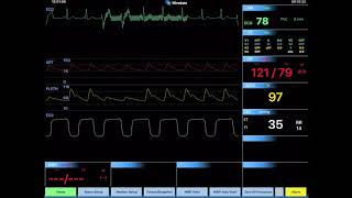 REALITi 113 Advanced ECG Controls [upl. by Dnomrej]