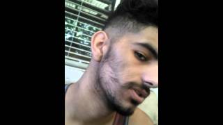 Minoxidil Beard Challenge Week 7 [upl. by Janella]