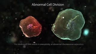 Testicular mesothelioma mesothelioma [upl. by Chadabe]