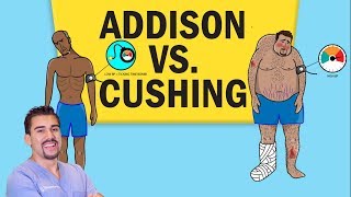 Addisons vs Cushings Disease for NCLEX RN [upl. by Eedna]