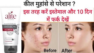 Alite anti acne face wash review in Hindi  मुँहासों और दाग़ धब्बो को मिटाये [upl. by Alyse]