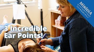 3 Powerful Ear Acupuncture Points that Enhance any Treatment [upl. by Alul]