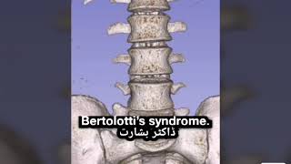 Bertolotti’s syndrome [upl. by Eceinwahs]