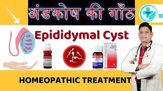 Epididymal Cyst Homeopathic Medicine  Best Treatment for Epididymitis  Dr Sunil Patidar [upl. by Howes]