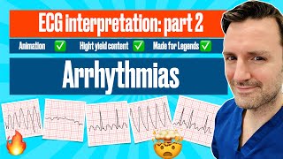 Arrhythmias A Visual Guide with ECG Criteria ecgmadeeasy [upl. by Petronella]