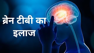 BRAIN TB  TB Meningitis  Tuberculoma  ब्रेन टीबी [upl. by Hellene561]