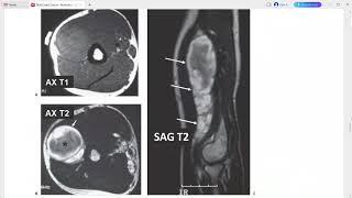 MSK 2 RAD CASE SERIES RADIOLOGY [upl. by Gusty]