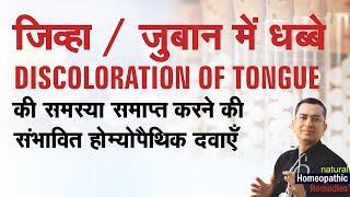 जिह्वा  ज़ुबान पर धब्बे  Discoloration of Tongue  Natural homeopathic remedies with symptoms [upl. by Tema]