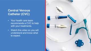 Central venous catheter procedure [upl. by Geraldina]