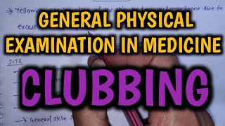 Clubbing  General Physical Examination in Medicine  Final Year MBBS Practical Exam [upl. by Tillman]