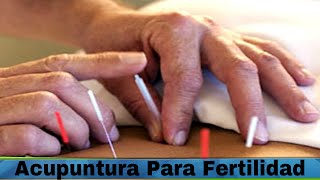 Acupuntura Para Fertilidad Como Usar La Acupuntura Para Fertilidad [upl. by Ymmor]