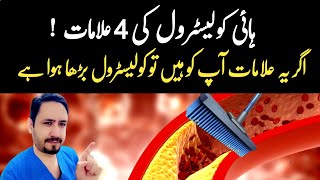 4 Warning Signs of High Cholesterol  Dr Irfan Azeem [upl. by Acinomaj]