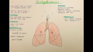 Histoplasmosis  pathophysiology histology clinics [upl. by Ennaillij]