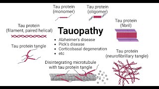 Microglial activation and tau transmission aggravated by Galectin3 in tauopathy [upl. by Ettenahc]