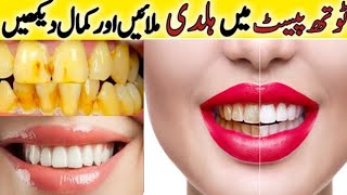 Fastest Way To Whiten Teeth At Home  What REALLY Works [upl. by Sethrida]