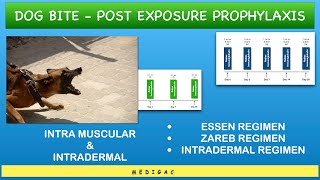 Rabies Post exposure prophylaxis  Intramuscular Essen  Zagreb amp Intradermal Regimen [upl. by Aekerly]