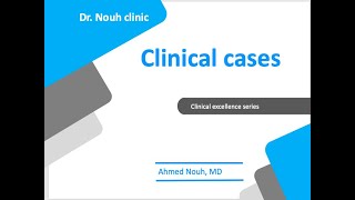 clinical cases discussion [upl. by Amata128]