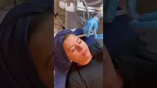 How Vampire Facial Works PRP Injection Treatment Explained  Vampire Facelift Guide shorts [upl. by Karlow]