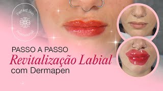 PASSO A PASSO Protocolo de REVITALIZAÇÃO LABIAL com Dermapen 👄 [upl. by Mariko]