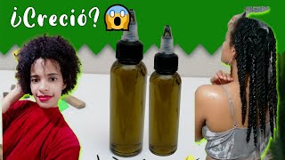 Cómo Hacer Crecer el Cabello con Aceites  RESULTADOS Reto Crecimiento 2023😍 [upl. by Gomez]