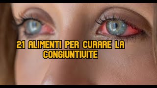 21 Alimenti per curare la congiuntivite [upl. by Ondrea295]