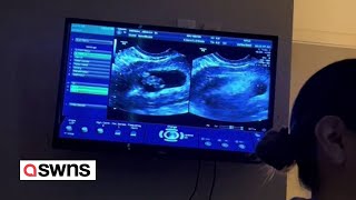 Moment couple found out they were expecting twins  for the second time  SWNS [upl. by Oneladgam]