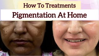 How to treatments pigmentation at home skin care 8130746923  NISHALAMBHA [upl. by Netsirhk]