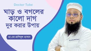 ঘাড় ও বগলের কালো দাগ দূর করার উপায়  Dark Underarms and Neck  Bangla Health Tips  Doctor Tube [upl. by Ihc259]