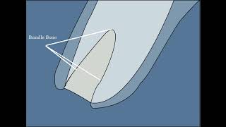 Sequence of bone remodeling after an extraction [upl. by Mehta]