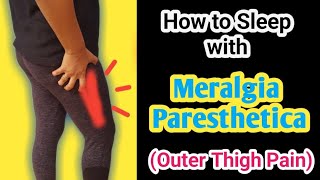 Tips to get relief from Meralgia Paresthetica  Selfcare tips  Outer thigh pain [upl. by Christoforo283]