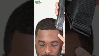 125 for Fixing Receding Hairline 🙌 [upl. by Changaris]