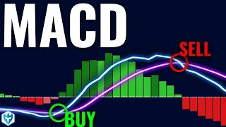 How I Nailed Trading with the MACD Indicator StepbyStep Guide [upl. by Lehcir]