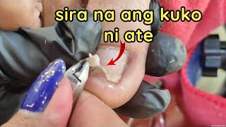 Vlog 1091Dry SkinIngrown Removal PEDICURE 991 [upl. by Atiluj]