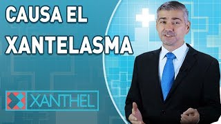 ¿Qué causa el xantelasma   Eliminar  Quitar Xantelasmas con Xanthel en Casa [upl. by Viglione906]