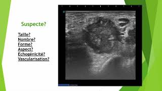 Les 6 points clés dune adénopathie suspecte en échographie [upl. by Asined824]