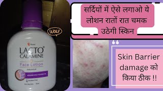 lacto calamine face lotion lacto calamine lotion for acne prone skin reviewlacto calamine lotion [upl. by Jacy]