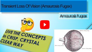 Transient Loss Of Vision Amaurosis Fugax [upl. by Einnaoj]