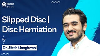 Slipped Disc and Disc Herniation By Dr Jitesh Manghwani  Conceptual Orthopedics [upl. by Ierdna]