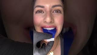 Clean your teeth regularly to check teeth bite strength！ dentist DIYbadbreath 🦷beadrepair [upl. by Yanahc]