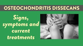 Osteochondritis dissecans OCD Signs symptoms and current treatments [upl. by Nilecoj817]