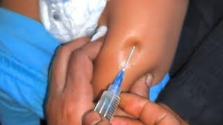 How to give an im Intramuscular injection in the buttocks [upl. by Lebazi535]