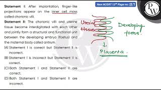 Statement I After implantation fingerlike projections appear on the inner cell mass called ch [upl. by Champaigne]