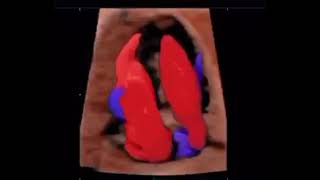 Ecocardiograma Fetal em 3D [upl. by Moersch]