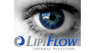 Lipiflow Thermal Pulsation  Dry Eye Treatment [upl. by Pineda]