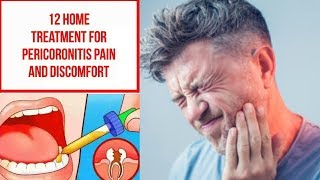 12 Home Treatment For Pericoronitis Pain and Discomfort [upl. by Ecirtaemed]