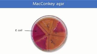 MacConkey agar หลักการ วิธีการอ่านผล  HCU [upl. by Attenaej]